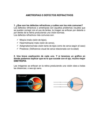 Ametropias o defectos refractivos