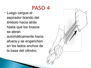 

Luego cargue el
aspirador tirando del
émbolo hacia atrás
hasta que los brazos
se abran
automáticamente hacia
afuera y se enganchen
en los lados anchos de
la base del cilindro.

 