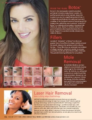 6

Fall / aesthetic medicine

Erase the Years

Botox

®

Botox® is the most popular cosmetic procedure
performed in America today. Botox® consists of a
purified protein which, when injected, relaxes the
muscles in an area for a significant period of time. It
is frequently used between the eyebrows to prevent
scowling, in the forehead to prevent furrowing and the
temple areas outside the eyes to prevent “crows feet.”
Botox® is a relatively safe procedure. Occasional side
effects do occur. Botox ® is found to alleviate migraine headaches when injected between the eyebrows. Dysport® is a product recently released and is
similar to Botox®.

Fillers
Juvéderm® , Restylane® or Perlane® are the most
popular lines of new fillers for deeper wrinkles around
the mouth, between the eyebrows and to enhance
the lips — These fillers have an extremely low incidence
of allergic reactions, and last six months to one year
around the mouth and about three months in the lips.
They provide instant gratification for our patients.

Mole
Removal
®

Results may vary.

BOTOX / FILLERS

BEFORE

AFTER

FILLERS

BEFORE

MOLE REMOVAL

AFTER

BEFORE

AFTER

At Aesthetic Medicine we have
adopted a new minimally invasive
technology for the removal of
moles. No incisions, no cutting and
no sutures are needed to perform
these procedures. Because we can
safely deliver in excess of 3 times
the energy of all other standard
laser and IPL hair removal systems,
we can give you a much more
effective treatment!

Laser edge thechnology
Hair Removal
New cutting
AESTHETIC MEDICINE is proud to announce that we are using the
most advanced technology for laser hair removal, ELOS™ (electro-optical
synergy) technology. Syneron’s patented ELOS™ technology couples the
Hair Removal “gold standard technology”, an 810nm diode laser, with
a secondary color blind energy source. This allows us to provide you, our
patients, with safer AND more effective laser hair removal treatments.
Because we can safely deliver in excess of 3 times the energy of all other
standard laser and IPL hair removal systems, we can give you a much more
effective treatment!
CALL 503.697.9777 for a FREE CONSULT View VIDEOS and SPECIALS online at www.drdarm.com

 
