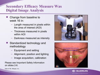 Secondary Efficacy Measure Was
Digital Image Analysis
 Change from baseline to
week 16 in:
– Length measured in pixels within
the area of interest (AOI)
– Thickness measured in pixels
within AOI
– Darkness measured as intensity
 Standardized technology and
methodology
– Equipment and setting
– Alignment, position and lighting
– Image acquisition, calibration
Data on file. Allergan, Inc.
Please see Important Safety Information
on slides 2-6.
 