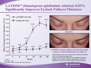 LATISSE®
(bimatoprost ophthalmic solution) 0.03%
Significantly Improves Eyelash Fullness/Thickness
*P<.0001.
Error bars = 2 SE.
Percentage change reported above each data point.
Week
MeanChangeFromBaseline(mm2
)
*
*
*
*
1 4 8 12 16 20
-0.10
0.00
0.10
0.20
0.30
0.40
0.50
0.60
0.70
0.80
0.90
9.9%
18.8%
11.7%10.2%10.1%
9.4%
5.1%
100.2%
106.0%
82.2%
34.6%
15.8%
LATISSE®
(N=136)
Vehicle (N=140)
LATISSE®
treated subject representing mean
change in fullness/thickness at week 16
Baseline
Individual results may vary. If discontinued, lashes will gradually
return to their previous appearance.
Patients should also be informed of the possibility of disparity
between eyes in length, thickness, pigmentation, number of
eyelashes or vellus hairs, and/or direction of eyelash growth.
 