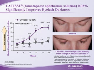 LATISSE®
(bimatoprost ophthalmic solution) 0.03%
Significantly Improves Eyelash Darkness
*P<.05; †P<.0001.
Error bars = 2 SE.
Percentage change reported above each data point.
LATISSE®
treated subject representing
mean change in darkness at week 16
LATISSE®
(N=137)
Vehicle (N=141)
MeanChangeFromBaseline(units)
Week
*
†
††
†
ImprovementImprovement
-25
-20
-15
-10
-5
0
5
1 4 8 12 16 20
2.5% 3.0%
3.6%
1.9%2.4%
4.9%
0.9%
18.0%18.2%
15.1%
8.1%
4.3%
Baseline
Individual results may vary. If discontinued, lashes will gradually
return to their previous appearance.
Patients should also be informed of the possibility of disparity
between eyes in length, thickness, pigmentation, number of
eyelashes or vellus hairs, and/or direction of eyelash growth.
 