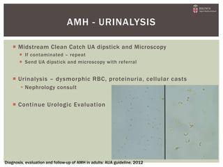  Midstream Clean Catch UA dipstick and Microscopy
 If contaminated – repeat
 Send UA dipstick and microscopy with referral
 Urinalysis – dysmorphic RBC, proteinuria, cellular casts
 Nephrology consult
 Continue Urologic Evaluation
AMH - URINALYSIS
Diagnosis, evaluation and follow-up of AMH in adults: AUA guideline, 2012
 
