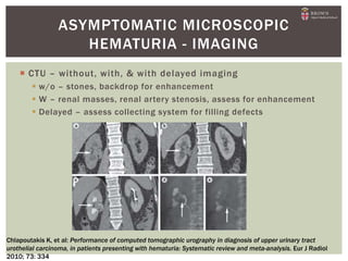  CTU – without, with, & with delayed imaging
 w/o – stones, backdrop for enhancement
 W – renal masses, renal artery stenosis, assess for enhancement
 Delayed – assess collecting system for filling defects
ASYMPTOMATIC MICROSCOPIC
HEMATURIA - IMAGING
Chlapoutakis K, et al: Performance of computed tomographic urography in diagnosis of upper urinary tract
urothelial carcinoma, in patients presenting with hematuria: Systematic review and meta-analysis. Eur J Radiol
2010; 73: 334
 