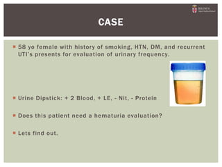  58 yo female with history of smoking, HTN, DM, and recurrent
UTI’s presents for evaluation of urinary frequency.
 Urine Dipstick: + 2 Blood, + LE, - Nit, - Protein
 Does this patient need a hematuria evaluation?
 Lets find out.
CASE
 