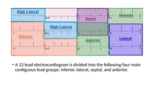 Acute Myocardial Infarction of the heart.pptx