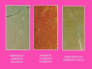 CRISÓLITO (ASBESTO BLANCO) AMOSITA (ASBESTO MARRÓN) CROCIDOLITA (ASBESTO AZUL) 