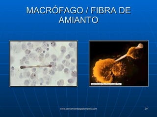 MACRÓFAGO / FIBRA DE AMIANTO 