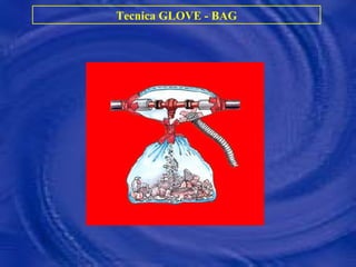 Tecnica GLOVE - BAG 