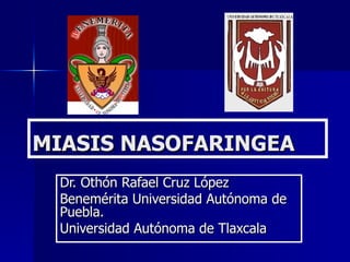 MIASIS NASOFARINGEA
 Dr. Othón Rafael Cruz López
 Benemérita Universidad Autónoma de
 Puebla.
 Universidad Autónoma de Tlaxcala
 
