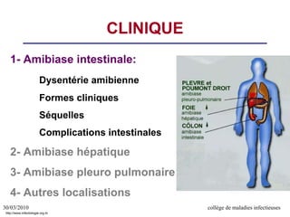 30/03/2010 collège de maladies infectieuses
CLINIQUE
1- Amibiase intestinale:
Dysentérie amibienne
Formes cliniques
Séquelles
Complications intestinales
2- Amibiase hépatique
3- Amibiase pleuro pulmonaire
4- Autres localisations
http://www.infectiologie.org.tn
 