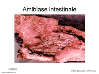 30/03/2010
collège de maladies infectieuses
Amibiase intestinale
http://www.infectiologie.org.tn
 