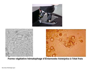 Examen à l’état frais
Forme végétative hématophage d’Entamoeba histolytica à l’état frais
http://www.infectiologie.org.tn
 