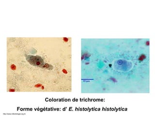 Examen après coloration
Coloration de trichrome:
Forme végétative: d’ E. histolytica histolytica
http://www.infectiologie.org.tn
 