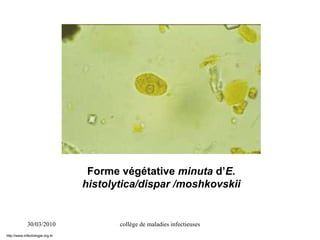 30/03/2010 collège de maladies infectieuses
Forme végétative minuta d’E.
histolytica/dispar /moshkovskii
http://www.infectiologie.org.tn
 