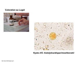 Kyste d’E. histolytica/dispar/moshkovskii
Examen après coloration
Coloration au Lugol
http://www.infectiologie.org.tn
 