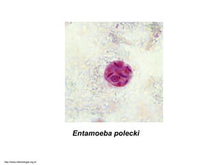 Entamoeba polecki
http://www.infectiologie.org.tn
 
