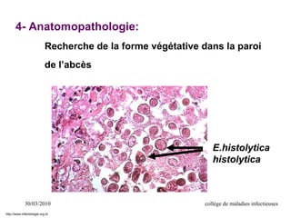 30/03/2010 collège de maladies infectieuses
4- Anatomopathologie:
Recherche de la forme végétative dans la paroi
de l’abcès
E.histolytica
histolytica
http://www.infectiologie.org.tn
 