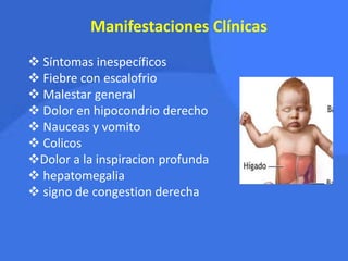 Manifestaciones Clínicas
 Síntomas inespecíficos
 Fiebre con escalofrio
 Malestar general
 Dolor en hipocondrio derecho
 Nauceas y vomito
 Colicos
Dolor a la inspiracion profunda
 hepatomegalia
 signo de congestion derecha
 