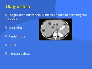 Diagnostico
 Diagnostico diferencial (Enfermedades hepatomegalia
dolorosa )
 Ecografía
 Radiografía
 ELISA
 hematologicos
 