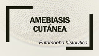 AMEBIASIS
CUTÁNEA
Entamoeba histolytica
 