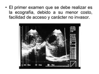 El primer examen que se debe realizar es la ecografía, debido a su menor costo, facilidad de acceso y carácter no invasor. 