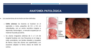 ANATOMÍA PATOLÓGICA
 Las características de las lesión son bien definidas:
o Colitis ulcerosa: las lesiones se localizan en el
sigmoides y recto, pequeñas de 0.1 a 0.5 cm
redondeadas, con un centro necrótico irregular y
deprimido, hemorrágico , a menudo ocupado por un
material mucoide purulento.
o las ulceras irregulares extensas de 1 a 5 cm de
longitud localizas con mas frecuencia en el ciego y
colon ascendente, con bordes elevados y ocupados
de fibrina. Estas dos ulceras son superficiales y en
ocasiones adoptan la forma clásica de botón de
camisa.
 