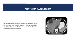 Las lesiones en el hígado se inician con pequeños focos
de necrosis que pueden crecer y formar cavidades
necrótico (E absesos). Predomina en el lóbulo derecho,
pueden ser únicas o múltiples.
ANATOMÍA PATOLÓGICA
 