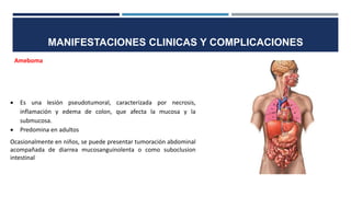 MANIFESTACIONES CLINICAS Y COMPLICACIONES
Ameboma
 Es una lesión pseudotumoral, caracterizada por necrosis,
inflamación y edema de colon, que afecta la mucosa y la
submucosa.
 Predomina en adultos
Ocasionalmente en niños, se puede presentar tumoración abdominal
acompañada de diarrea mucosanguinolenta o como suboclusion
intestinal
 