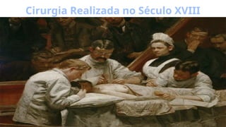 Cirurgia Realizada no Século XVIII
 