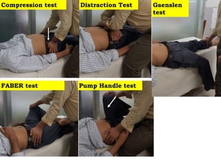 Compression test Distraction Test Gaenslen
test
FABER test Pump Handle test
 