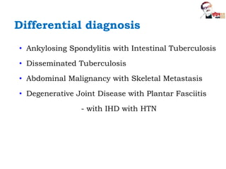 Differential diagnosis
• Ankylosing Spondylitis with Intestinal Tuberculosis
• Disseminated Tuberculosis
• Abdominal Malignancy with Skeletal Metastasis
• Degenerative Joint Disease with Plantar Fasciitis
- with IHD with HTN
 