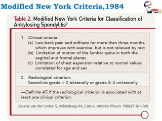 Modified New York Criteria,1984
 