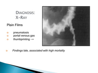 Plain Films
 pneumatosis
 portal venous gas
 thumbprinting →
 Findings late, associated with high mortality
 
