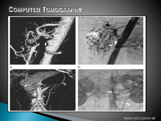 Radiol 2003;229:91-98
 