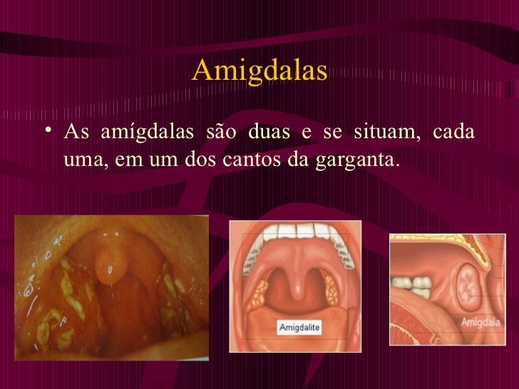 Amigdalas E Adenoides – O Que São Adenoides – BXXM