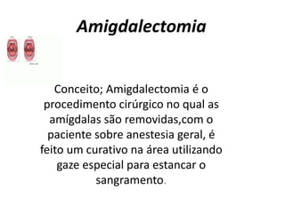 Amigdalectomia 
Conceito; Amigdalectomia é o 
procedimento cirúrgico no qual as 
amígdalas são removidas,com o 
paciente sobre anestesia geral, é 
feito um curativo na área utilizando 
gaze especial para estancar o 
sangramento. 
 