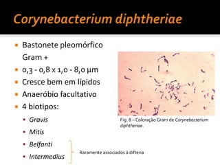 Corynebacteriumdiphtheriae