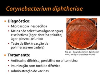 Haemophilusinfluenzae