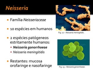 Borreliavicentie bacilos fusiformes (Angina de Vicent)Figs. 3 e 4– Streptococcus pyogenes.