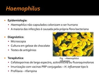 CorynebacteriumdiphtheriaeDiagnóstico:Microscopia inespecíficaMeios não selectivos (ágar-sangue) e selectivos (ágar-cisteína-telurito; ágar-plasma-telurito)Teste de Elek (reacção da polimerase em cadeia)Fig. 10 – Corynebacterium diphtheriae mitis, em ágar-chocolate-telurito Tratamento: