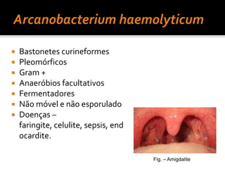 Antitoxina diftérica, penicilina ou eritomicina