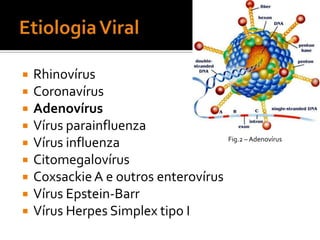 Principal sintoma: dor de garganta