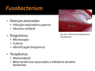 HaemophilusFamilia PasteurellaceaeCocobacilos ou bastonetes pequenosPleomórficosGram –Anaeróbios facultativosFermentadoresMaioria das espécies requer hemina e NAD para o crescimentoFig. 18 – Colorações de Gram de Haemophilusinfluenzae.