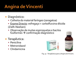 HaemophilusinfluenzaeDiferenciação sorológica:Presença de antigénios capsularesSorotipos de a-fTipo b – mais virulento (vacina HIB)Diferenciação bioquímica:Biotipos de I-VIIIReacções bioquímicas – produção de indol, urease e ornitina descarboxilaseDiferenciação em biogrupos: Utilização clinicaBiogrupo aegypticus – febre purpúrica brasileiraFig.  20  – Haemophilusinfluenzae.