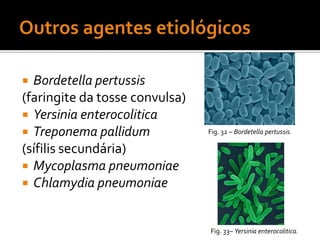 HaemophilusEpidemiologia:Haemophilus não-capsulados colonizam o ser humanoA maioria das infecções é causada pela própria flora bacterianaDiagnóstico:MicroscopiaCultura em gelose de chocolateTestes de antigéniosTerapêutica: Cefalosporinas de largo espectro, azitromicina ou fluoroquinolonasImunização com vacinas PRP conjugadas – H. influenzae tipo bProfilaxia - rifampinaFig.  –Haemophilus influenzae.