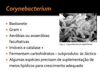 StreptococcuspyogenesFig.1 – Amígdalas edemaciadas, hiperemiadas e purulentas