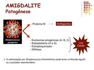 AMIGDALITE
Patogénese
- Proteína M
Streptococcus
pyogenes
- Exotoxinas pirogénicas (A, B, C)
- Estreptolisina (O e S)
- Estreptoquinases
- DNAses
Lise
Celular
Antifagocítica
 A colonização por Streptococcus β-hemolíticos pode levar a infecção aguda
ou a portador assintomático
 