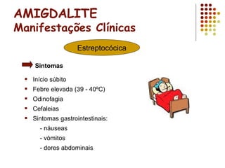 AMIGDALITE
Manifestações Clínicas
 Início súbito
 Febre elevada (39 - 40ºC)
 Odinofagia
 Cefaleias
 Sintomas gastrointestinais:
- náuseas
- vómitos
- dores abdominais
Estreptocócica
Sintomas
 