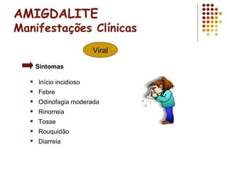 AMIGDALITE
Manifestações Clínicas
 Início incidioso
 Febre
 Odinofagia moderada
 Rinorreia
 Tosse
 Rouquidão
 Diarreia
Viral
Sintomas
 